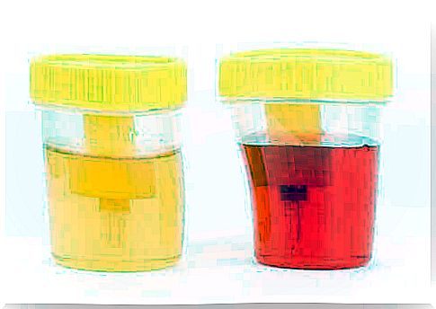 Presence of blood in dog urine